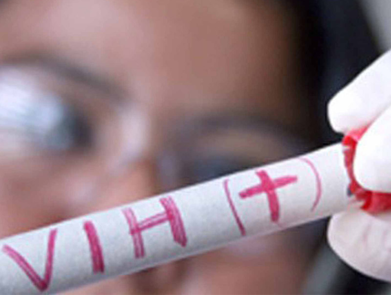 Seis cosas que debes saber para prevenir el contagio del VIH