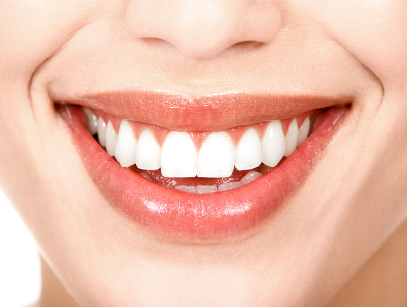 Que la caries dental no le robe la sonrisa