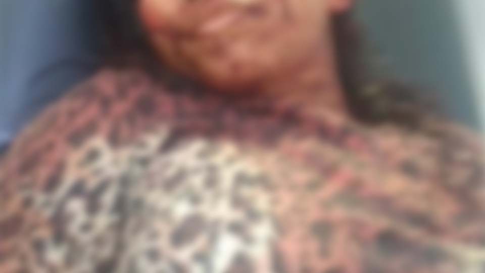 Brutal agresión a una mujer en Curumaní, Cesar