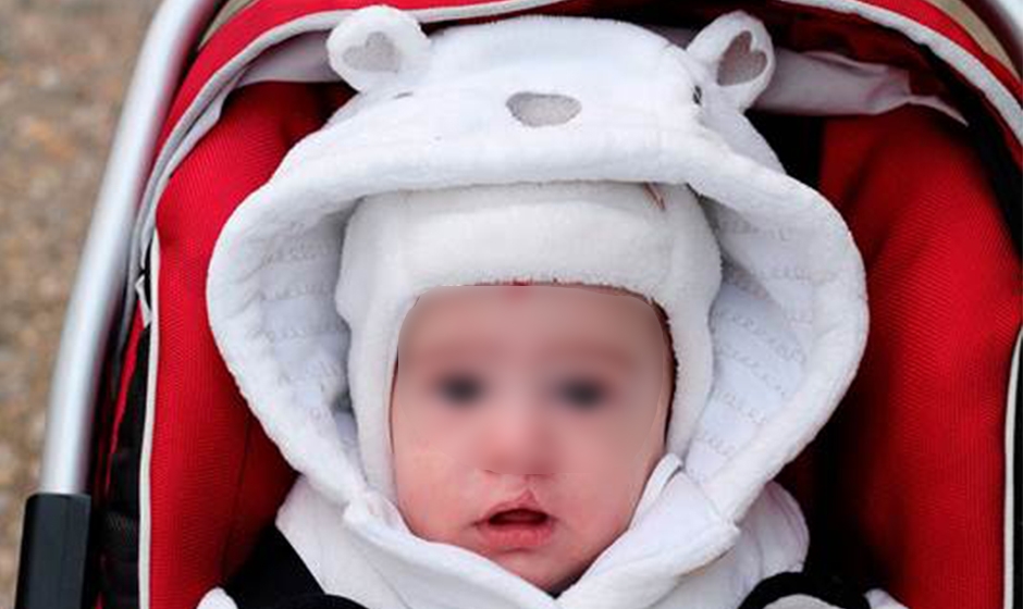 ¿Qué es el labio y paladar fisurado?